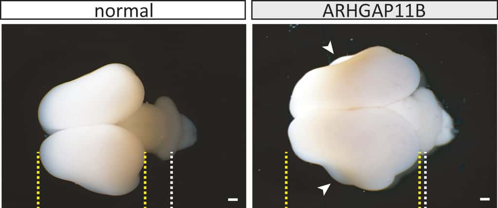 Cerveau de ouistiti normal (à gauche) et modifié avec le gène ARHGAP11B (à droite). La taille du cortex cérébral (lignes jaunes) est accrue chez les singes transgéniques. © Heide et al, MPI-CBG