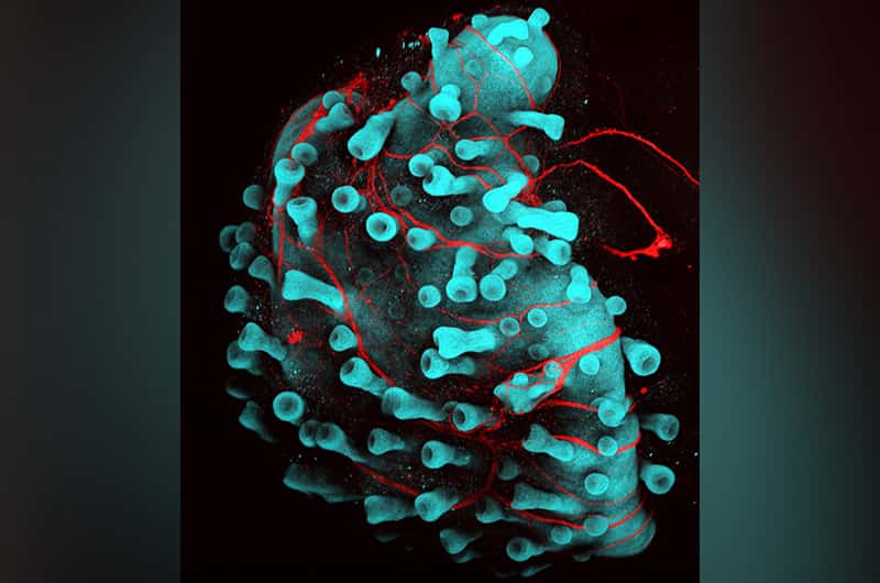 Image d’un cellule de peau humaine en développement dotée de follicules pileux (bourgeons sur la cellule). En rouge, les nerfs innervant la cellule. © Jiyoon Lee, <em>Boston Children's Hospital</em>