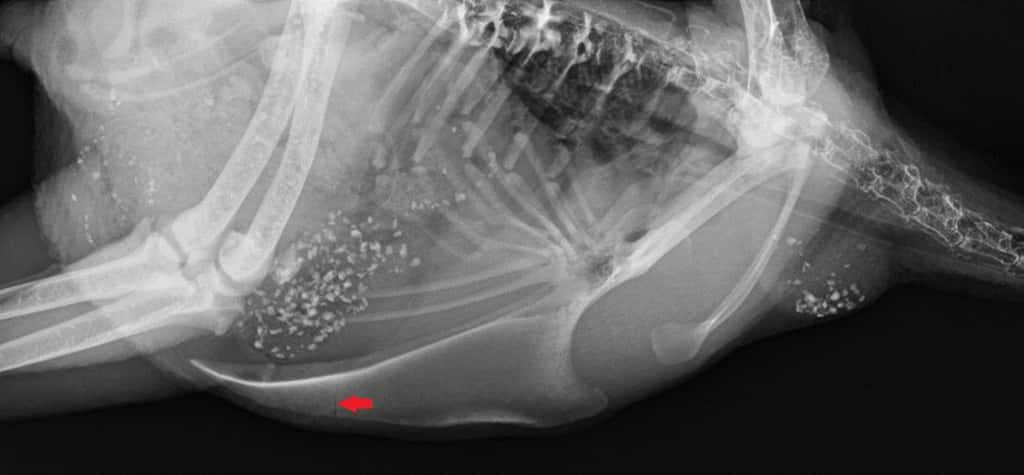 Une radiographie de fracture du bréchet. © Beryl Katharina Eusemann et al., <em>Plos One,</em> 2018