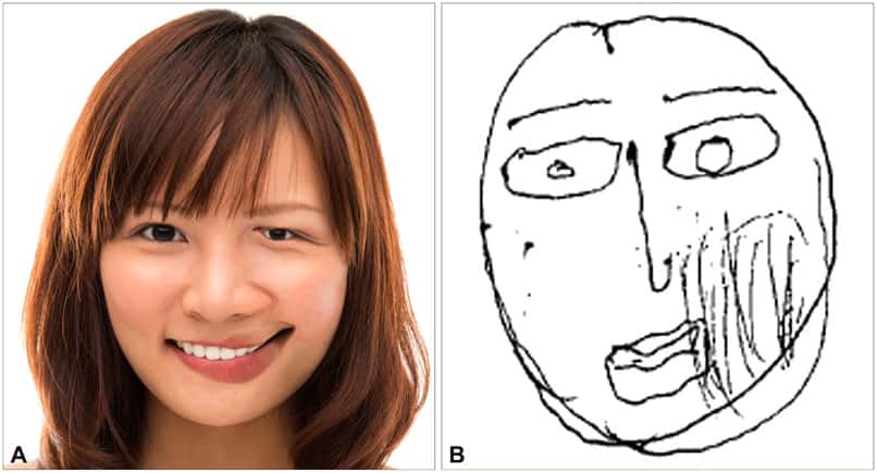 Reconstitution d’un visage d’après la description d’une patiente sud-coréenne de 52 ans. © Chang-Min Lee, <em><a href="https://synapse.koreamed.org/articles/1120337" target="_blank">Dement Neurocognitive Disord</a>,</em> 2015