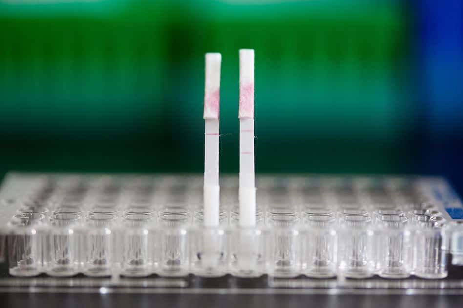 Le test urinaire s’appuie sur le même principe que les tests de grossesse, où une bandelette de papier réagit à un biomarqueur. © Bryce Vickmark