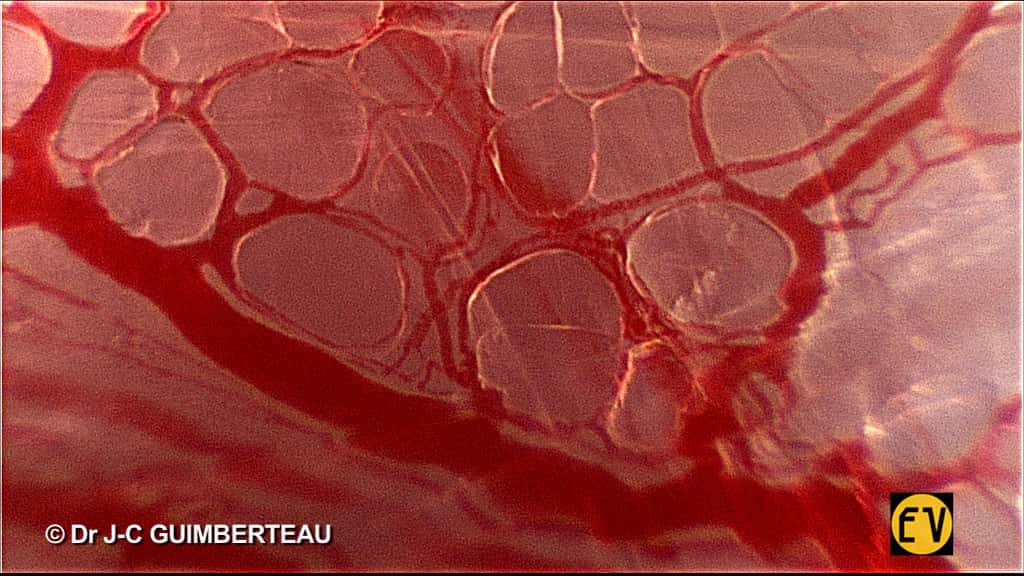 Des cellules entourées de vaisseaux sanguins : cela se passe sous la peau. © Jean-Claude Guimberteau