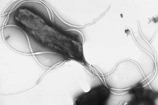 La bactérie Helicobacter pylori infecte la muqueuse gastrique et cause de nombreux ulcères qui parfois deviennent des cancers de l'estomac. Elle est l'une des principales causes de cancers dus à des infections. © Yutaka Tstutsumi, Wikipédia