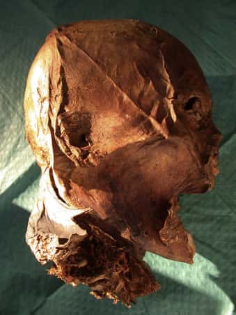 Voici le crâne de la discorde. Si morphologiquement il ressemble à celui d'Henri IV, la génétique pourrait révéler des différences. © Philippe Charlier <em>et al.</em>, <em>Forensic Science International</em>