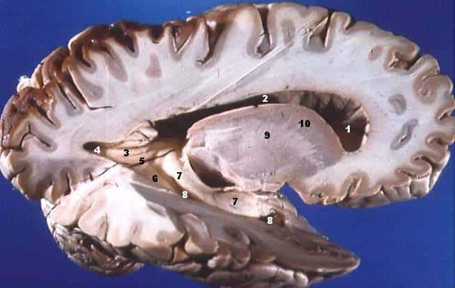 Le cerveau se divise en deux parties : la substance grise, face externe, où se situent les corps cellulaires des neurones et la substance blanche, face interne, regroupant principalement les axones, c'est-à-dire les prolongements des neurones. © John A. Beal, Wikimedia Commons, cc by sa 2.5