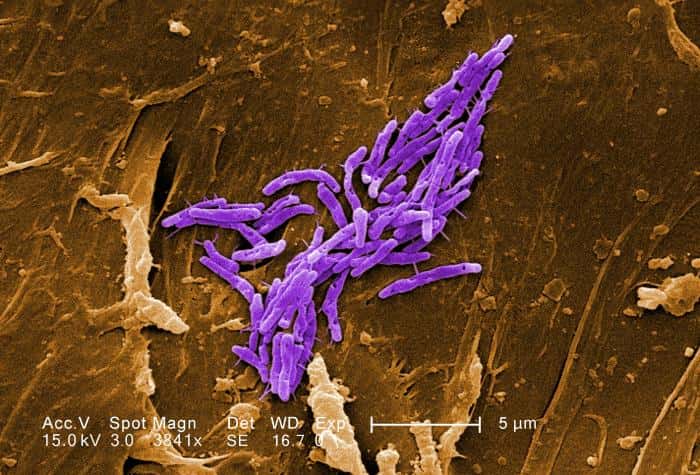 La tuberculose, responsable de la mort de 1,5 million de personnes en 2013, est causée par la bactérie <em>Mycobacterium tuberculosis</em>. © Janice Haney Carr, CDC