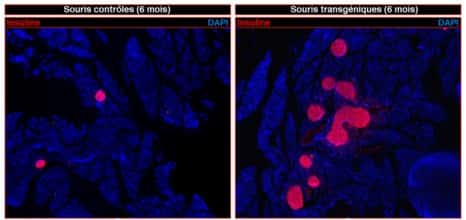 L'activation du gène <em>Pax4</em> dans le pancréas de souris transgéniques induit la régénération massive de cellules bêta productrices d'insuline (visibles en rose à droite). L'image de gauche correspond au pancréas de souris contrôles. © Patrick Collombat, Inserm