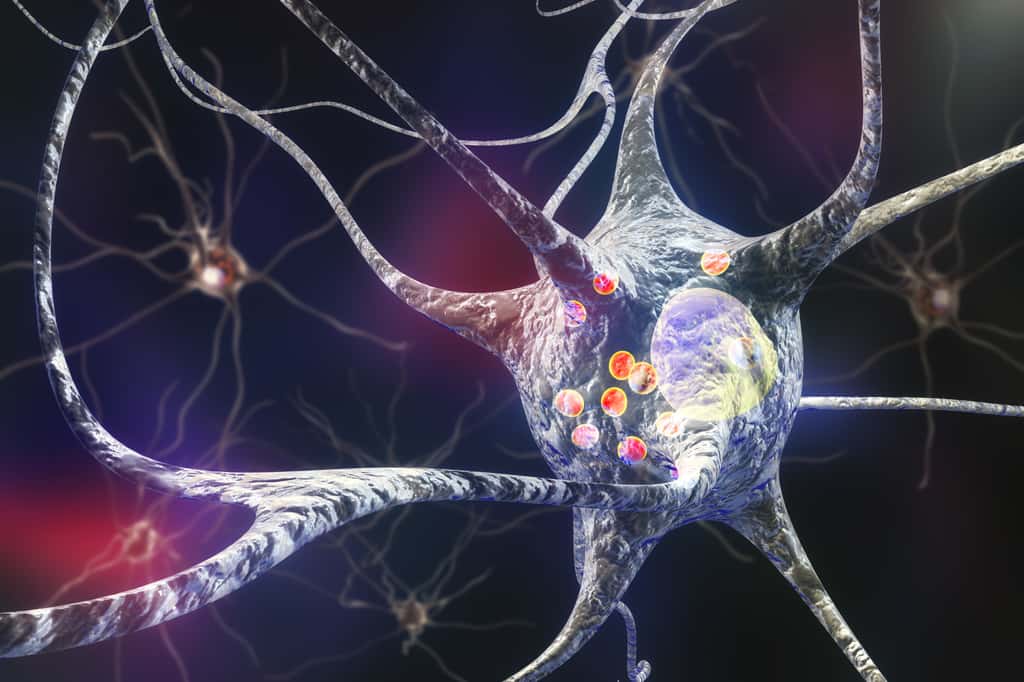 Illustration d'un neurone où les corps de Lewy sont représentés par les sphères rouges. Les corps de Lewy sont des amas protéiques d'alpha-synucléine toxiques pour les neurones. © Kateryna_Kon, Adobe Stock