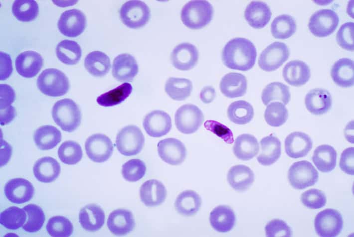 Le paludisme est une maladie infectieuse causée par des parasites du genre Plasmodium. L'espèce la plus dangereuse est Plasmodium falciparum, ici à l'image. Son cycle de vie en plusieurs phases rend les traitements difficiles. ELQ-300, en s'attaquant à ces différents stades, semble plus efficace que les médicaments actuels. © Center for Disease Control, Wikimedia Commons, cc by sa 3.0
