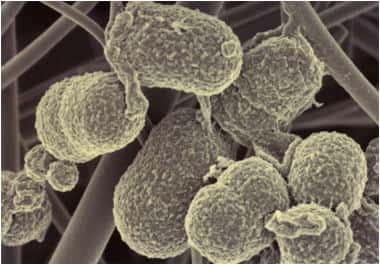 Prevotella intermedia est une des bactéries intestinales prépondérantes dans un des assemblages identifiés par les chercheurs. © DR