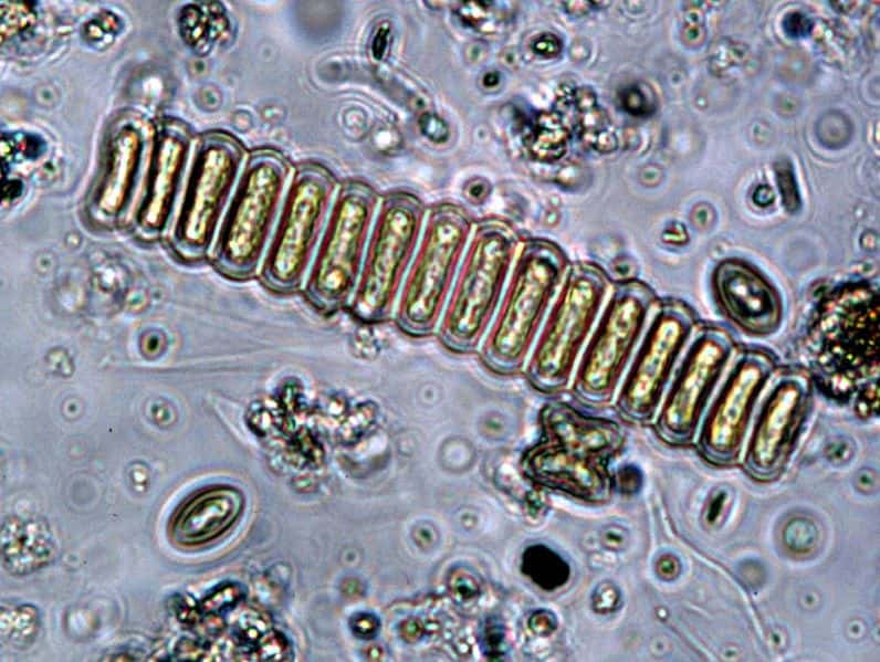 L'algue Scenedesmus et son biocarburant pourraient être une solution alternative au pétrole. © EPA, domaine public