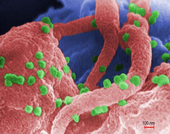Le VIH, ici en vert, descend d'une souche de VIS. Tous deux infestent et tuent de préférence les lymphocytes T CD4+, acteurs indispensables de l'immunité. Sauf si l’on inocule à l'organisme le bon vaccin... © C. Goldsmith <em>et al.</em>, CDC