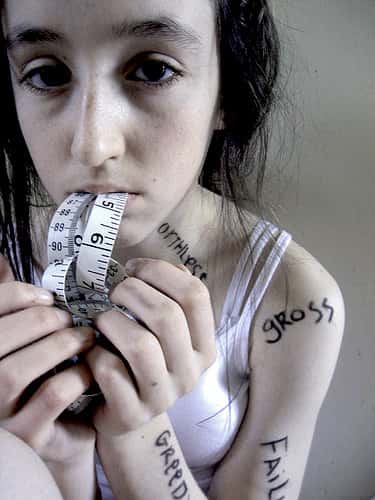 L'anorexie est une maladie qui frappe souvent des adolescentes, avec des conséquences parfois dramatiques. © habacuc_1988, Flickr, cc by nc sa 2.0
