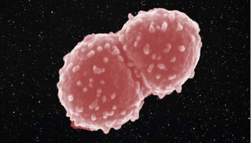 <em>Deinococcus radiodurans</em>, la bactérie qui a survécu un an dans l’espace et qui s’est adaptée à la vie dans ces conditions extrêmes. © Tetyana Milojevic, Université de Vienne