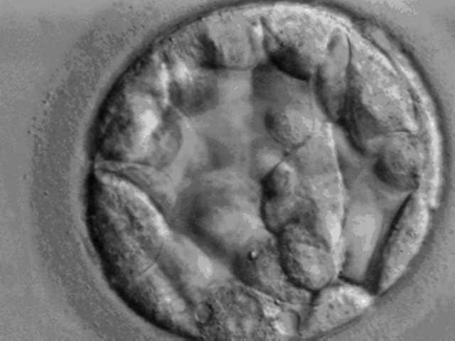 À cinq jours, un embryon est au stade blastocyste et ressemble à cela. C'est à ce stade que les cellules dont l'ADN est séquencé sont prélevées. © Ekern, Wikipédia, DP