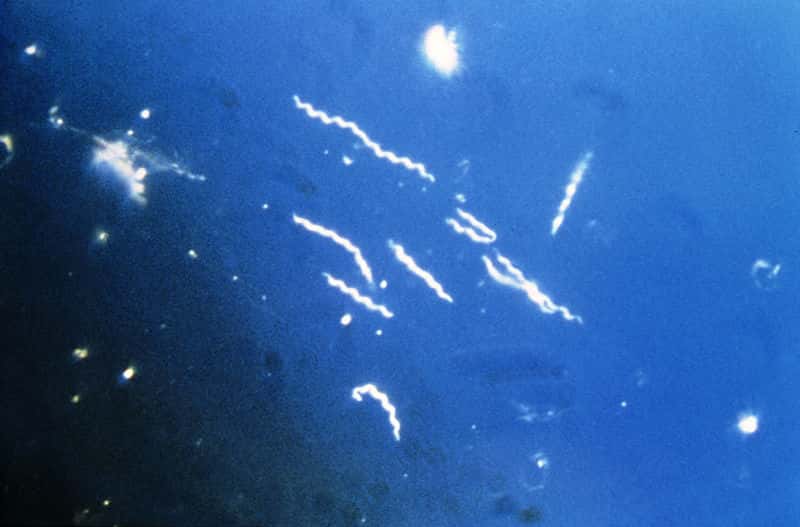 Les borrélies sont un genre de bactéries spiralées du groupe des spirochètes. <em>Borrelia burgdorferi</em> est la première espèce identifiée responsable de la maladie de Lyme. Trois autres espèces ont depuis montré qu’elles pouvaient également déclencher cette maladie. © CDC, DP