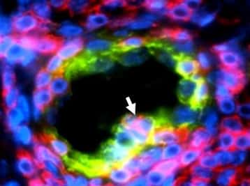 Visualisation en microscopie d'une coupe de tumeur du sein montrant un vaisseau sanguin HEV (en vert) entouré de lymphocytes (en rouge). La flèche blanche indique un lymphocyte en train de se faufiler à travers le vaisseau HEV. © Jean-Philippe Girard - IPBS (CNRS/université Toulouse III – Paul Sabatier)