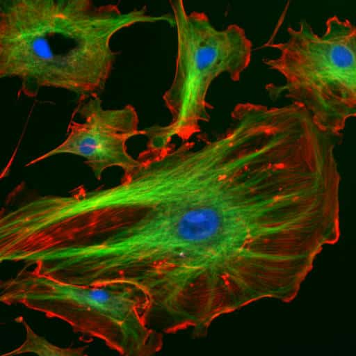 Les cellules endothéliales, ici représentées, tapissent l'intérieur de la paroi des vaisseaux sanguins et sont sensibles à la microgravité, qui les fait vieillir plus vite. © NIH, Wikipédia, DP