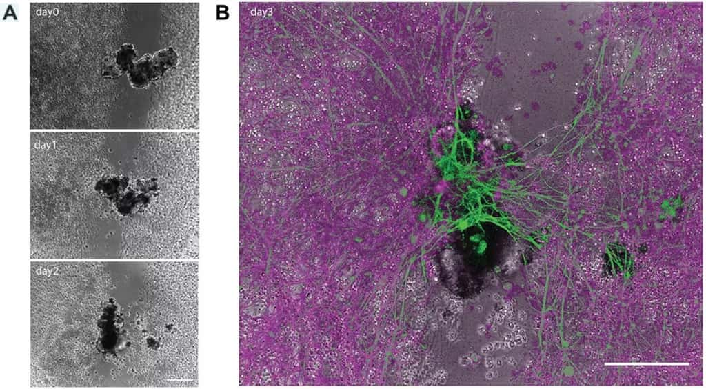 Sur les photos A, un anthropobot construisant un pont sur un neurone abimé. La figure B met en évidence le pont en vert à la fin du jour 3. © Gumuskaya et al. 2023, <em>Advanced Science</em>, CC BY-SA