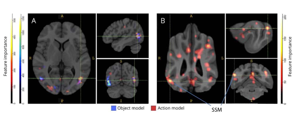 Les différences observées par les chercheurs de l’université Emory (États-Unis) entre des cerveaux humains (A) et des cerveaux de chiens (B). © <em>Journal of Visualized Experiments</em> (2022)