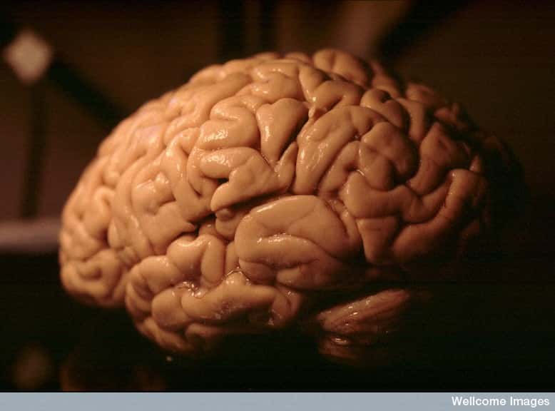 Le cerveau humain fait l'objet de bien des investigations de la part des neurobiologistes. © Heidi Cartwright, Wellcome Images, Flickr, CC by-nc-nd 2.0