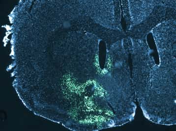 Cette image de microscopie à fluorescence représente une coupe de cerveau de souris au niveau du noyau accumbens, une région impliquée entre autres dans la récompense et la motivation. Le bleu correspond au noyau des cellules et le vert à une région cellulaire où l’enzyme responsable de la dégradation des lipides a été éliminée. © Serge Luquet
