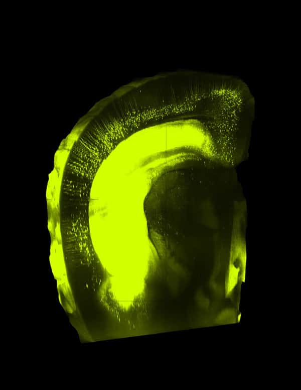 Coupe du cerveau d’une souris rendu transparent avec la solution SeeDB, puis coloré par des anticorps fluorescents. © Riken