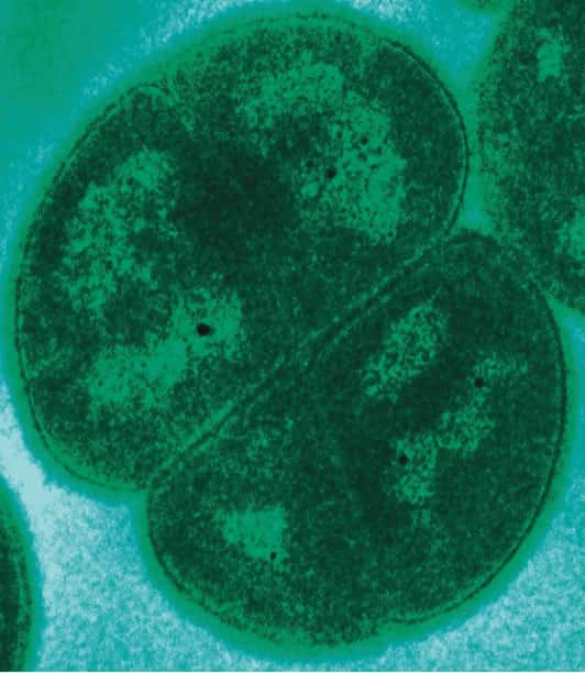 <em>Deinococcus radiodurans</em> vue en micrographie électronique à transmission. © Michael Daly, <em>Uniformed Services University</em>, Bethesda, Wikipédia. Domaine public