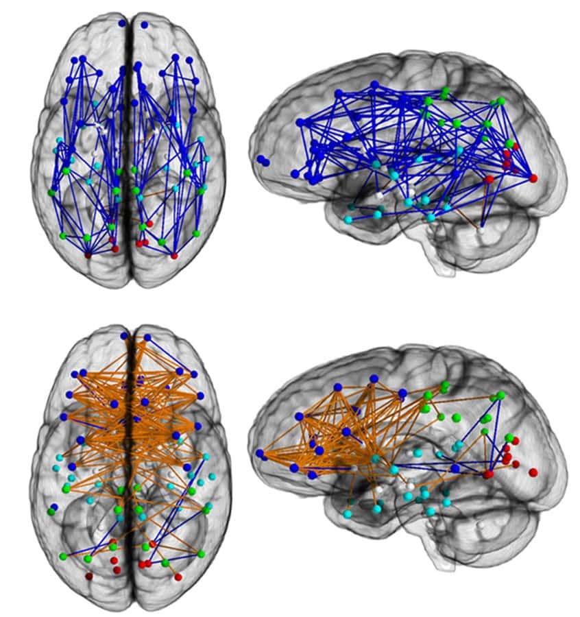 On observe davantage de connexions intrahémisphériques chez les hommes (en haut, en bleu), mais plus de connexions intrerhémisphériques chez les femmes (en bas, en orange). © Ragini Verma <em>et al.</em>, université de Pennsylvanie