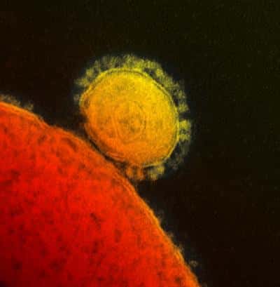 Le coronavirus MERS-CoV, visible ici, est apparu spontanément en 2012, alors qu'il était inconnu jusque-là. Mais d'où vient-il ? La chauve-souris semble être son origine principale. © NIAID, RML, DP