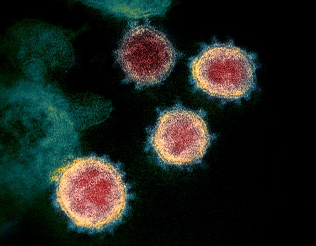 Le SARS-CoV-2 n'est pas un virus intelligent et diabolique. C'est un virus, comme un autre, ou presque. © Niaid, RML, <em>Wikimedia Commons</em>, Flickr, CC by-sa 2.0