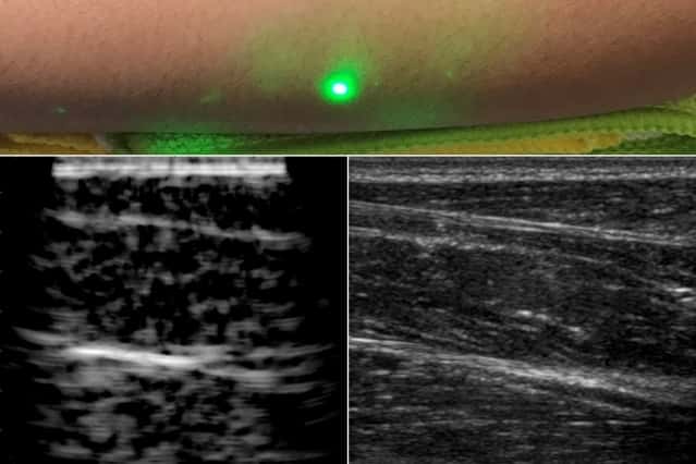 Les chercheurs du MIT (États-Unis) ont utilisé leur nouvelle technique d’imagerie ultrasons laser pour scanner des avant-bras (image à gauche) ; et pour comparaison (à droite), la même image prise par échographie classique. Ils ont ainsi pu « voir » jusqu’à six centimètres sous la peau avec un laser placé à un demi-mètre des volontaires. © <em>Massachusetts Institute of Technology</em>