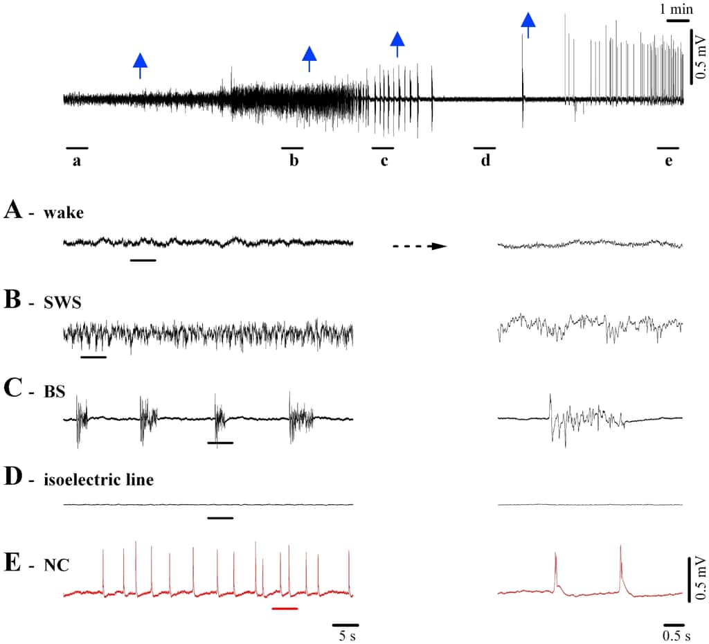 Ces graphiques montrent l'évolution des tracés encéphalographiques des chats au cours du temps. En A, ils sont éveillés. En B et C, ils plongent dans un coma de plus en plus profond, l'activité électrique du cerveau diminuant fortement. En D, on obtient quasiment une ligne isoélectrique. Mais en E, alors que les doses d'anesthésiques sont plus importantes (les flèches bleues indiquant les injections), on retrouve une activité cérébrale marquée au niveau de l'hippocampe et qui se propage jusqu'au cortex. Ce sont les complexes nu. © D. Kroeger <em>et al.</em>, <em>Plos One</em>, cc by 2.5