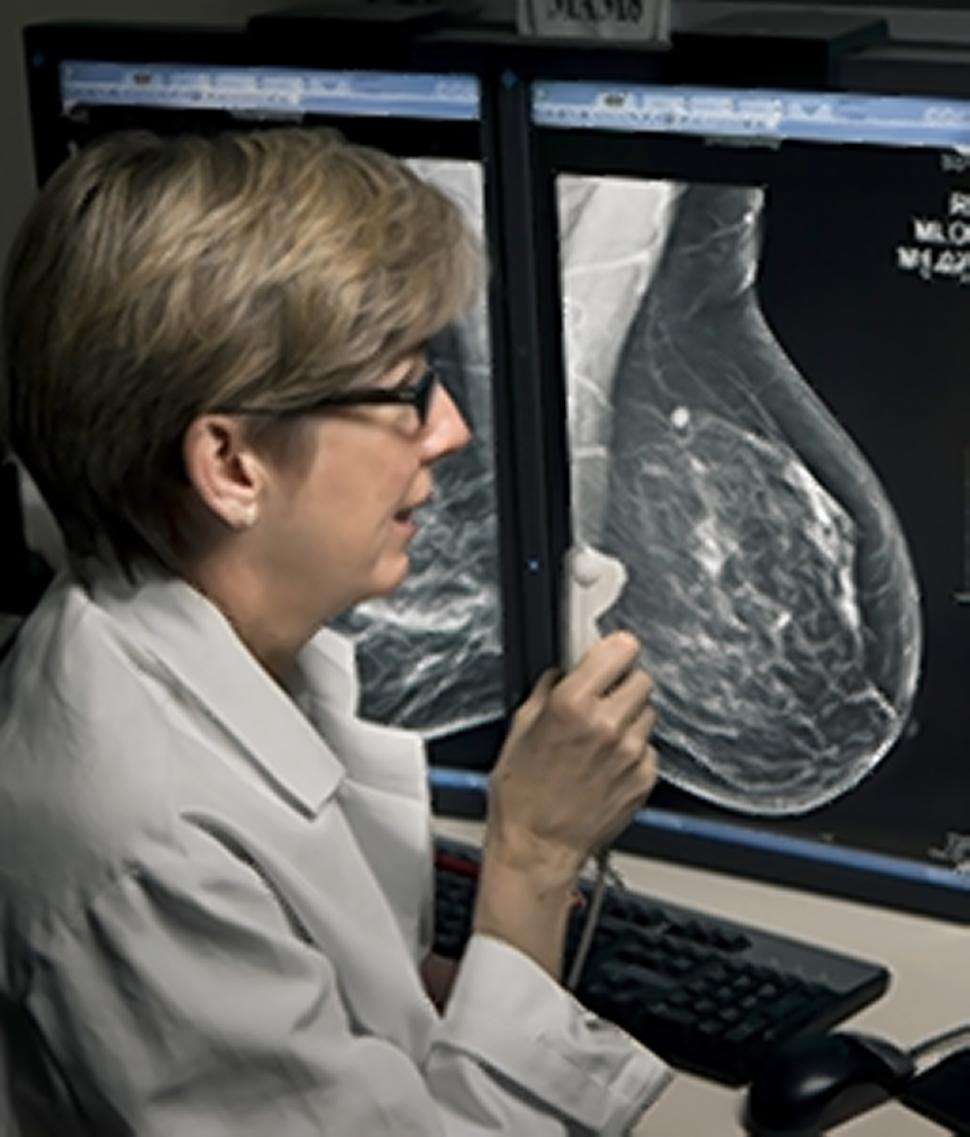 Emily F. Conant, chef du départ d’imagerie du sein qui a supervisé cette étude se dit enthousiasmée par cette technologie qui ne va cesser de s’améliorer au cours des prochaines années. © <em>Penn Medecine</em>