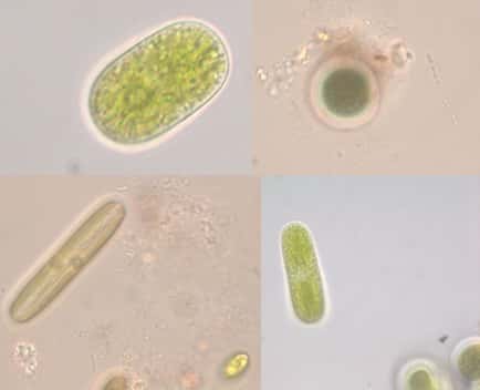 Des algues terrestres comme on en trouve dans les tourbières : des algues vertes, des diatomées et des cyanobactéries. © Vincent Jassey, CNRS