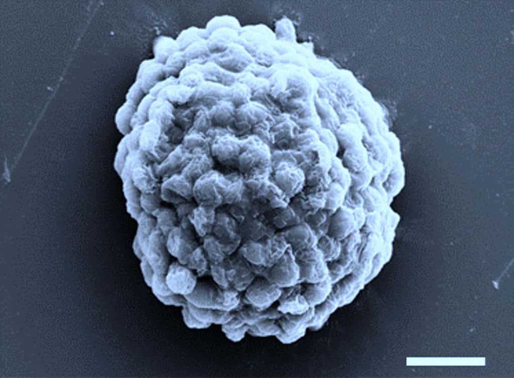 Un cliché pris en microscopie électronique d’une gouttelette dense de cellules d’algues produisant de l’hydrogène. La barre d’échelle représente 10 micromètres. © Xin Huang, Institut de technologie Harbin