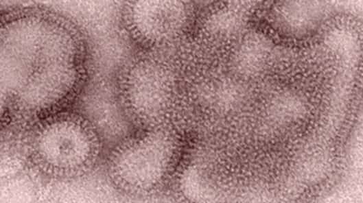 Une nouvelle souche grippale, A (H3N2v), vient inquiéter les autorités américaines. En 1 mois, 152 cas ont été recensés. Pour l'instant, ce virus ne se transmet pas d'Homme à Homme. © CDC Atlanta
