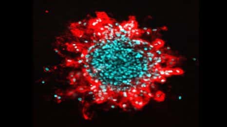 Images de cellules tumorales humaines qui envahissent une matrice de collagène. Les noyaux sont colorés en bleu et la partie de la matrice extracellulaire dégradée par les cellules en rouge. © Guilherme Nader, Institut Curie