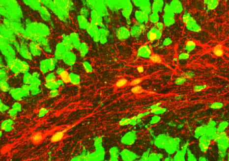 Image de microscopie confocale montrant des neurones induits (rouges avec un noyau jaune) exprimant le marqueur neuronal NeuN (vert) au sein d’un hippocampe de souris épileptique. © Extrait de : Lentini et <em>al., Cell Stem Cell</em>, 2021