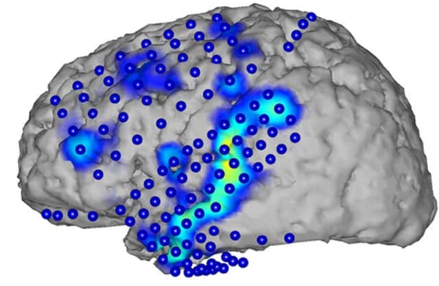 Cette image permet de suivre le procédé d’enregistrement des ondes cérébrales associées au langage et à la parole par électrocorticographie (ECoG). Les électrodes (cercles bleues) détectent l’activité cérébrale spécifique (zones bleues et jaunes) qui se produit à chaque mot. © CSL, KIT