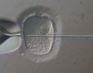 Injection d'en spermatozoïdes dans un ovule in-vitro.Crédits : CHU Toulouse