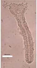 Côlon humain, observation microscopique sous lumière naturelle. © INRA / B. Kaeffe