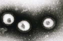 Image en microscopie électronique du virus de la grippe.