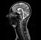 Image du cerveau obtenue en IRM