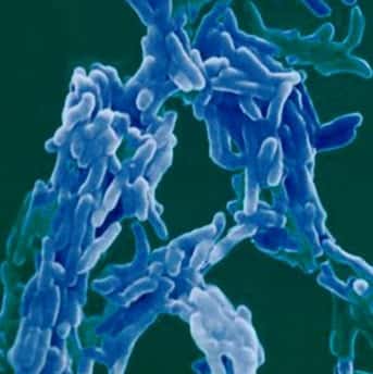 Bacille de la tuberculose (Mycobacterium tuberculosis), le responsable de la maladie de la tuberculose. &copy; Gounon, P. / Institut Pasteur Service Photo