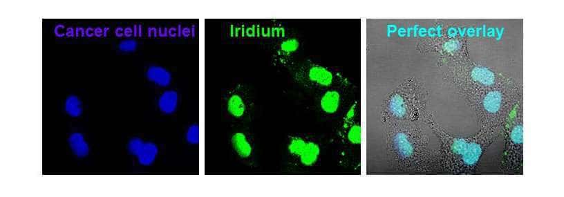 Associé à l’albumine, le composé à base d’iridium conçu par les chercheurs de l’université de Warwick devient fortement luminescent. De quoi suivre son évolution en temps réel. Ici, à gauche, des noyaux de cellules cancéreuses ; au centre, des composés à base d’iridium luminescents ; et à droite, la parfaite corrélation entre les deux. © Université de Warwick