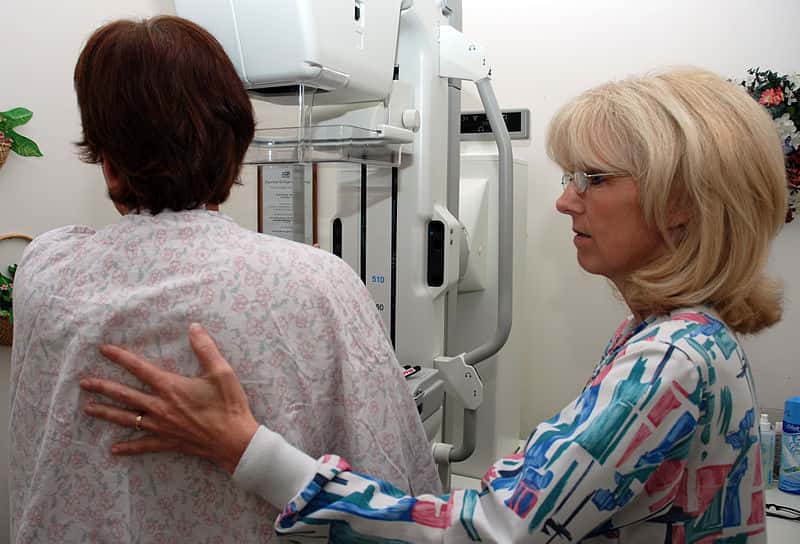La mammographie reste aujourd'hui l'un des moyens les plus répandus pour détecter les tumeurs cancéreuses du sein. © Joseph Moon, Wikimedia Commons, DP