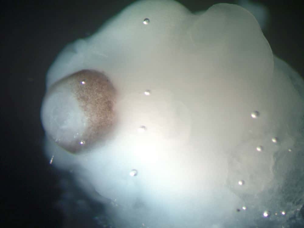 Cette image d'un organoïde cérébral laisse apparaître de l'épithélium rétinien (en marron) entouré de tissu cérébral. © Madeline Lancaster <em>et al.</em>, <em>Nature</em>