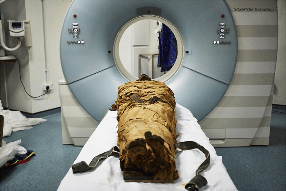 Le corps momifié de Nesyamun, prêt à passer au scanner de l’université de Leeds. Le prêtre égyptien officiait sous le règne de Ramsès XI, il y a quelque 3.000 ans. © <em>Leeds Teaching Hospitals, Leeds Museums and Galleries</em>
