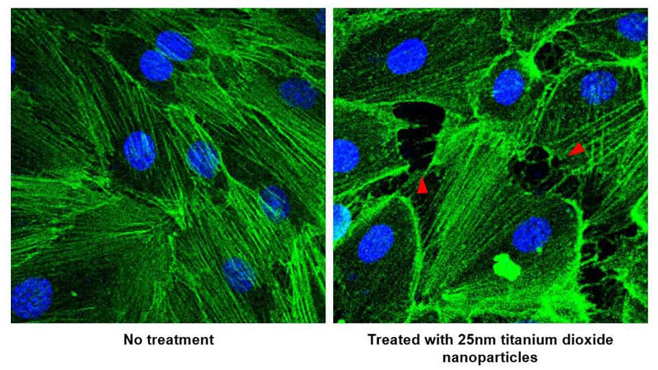 À gauche, des vaisseaux sanguins et des nanoparticules de dioxyde de titane. À droite, le résultat d’une exposition de 30 minutes. On observe bien la nouvelle porosité des vaisseaux sanguins. © Université nationale de Singapour